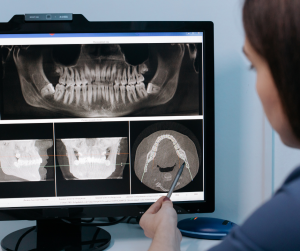 Essential Dental Tools for Practices
