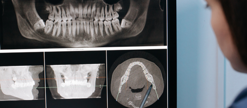 Essential Dental Tools for Practices